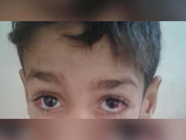 A child in need for an eye surgery