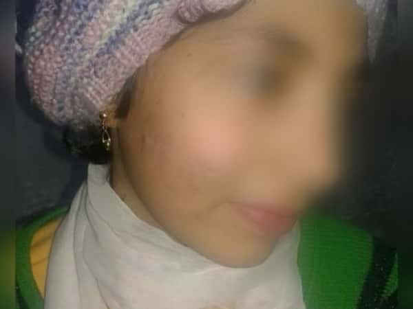 child in need for cornea implantation