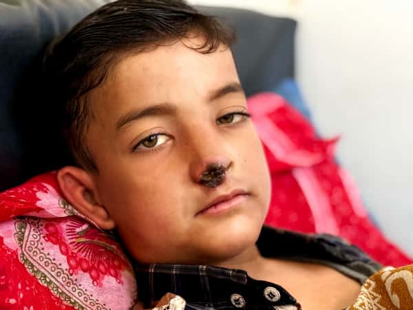 A Chance for Ahmad to Heal