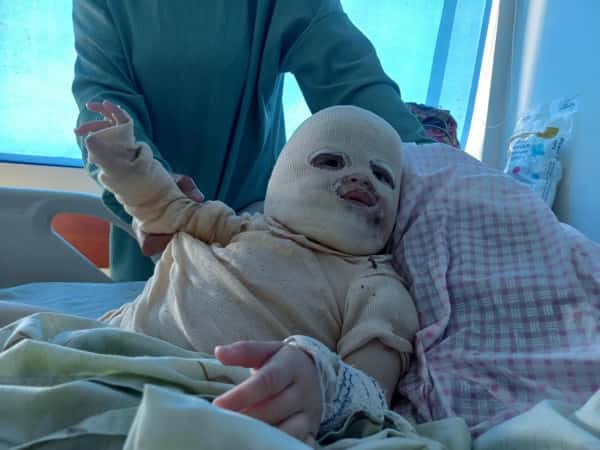 استجابة للنازحين - 2024