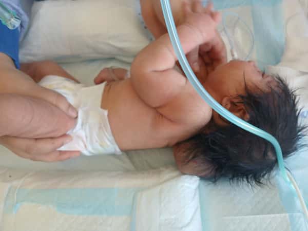 Mal- Alsham is a new born baby who needs your help to survive!