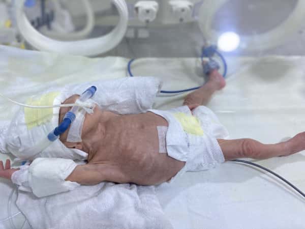 Baby Fatima is in need of your help