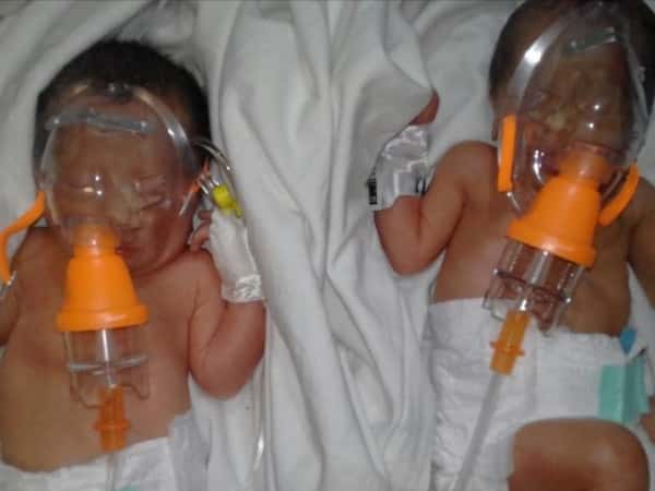 Two babies need basic needs.