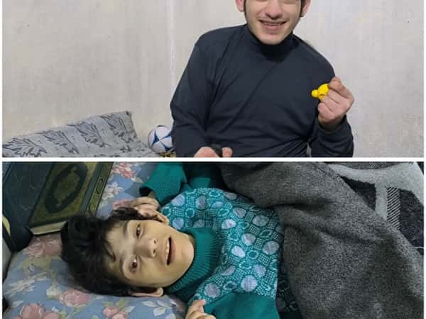 Two Children Living with Muscular Atrophy.