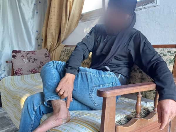 One Medical Boot Between Ali and His Work