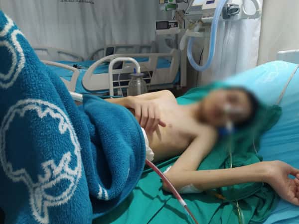 Ahmad has acute malabsorption and needs your urgent support