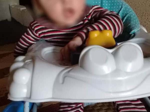 طفلة مصابة بالصرع بحاجة أدوية وحليب أطفال.