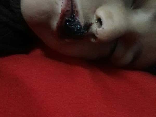 kid needs immediate treatment