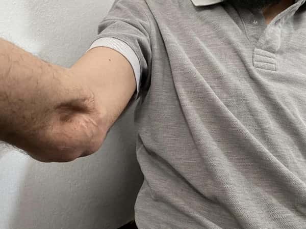 Abdul Rahman is injured as well as in need of your assistance.