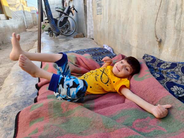 Yasmine Has Been Facing Pain Since Birth