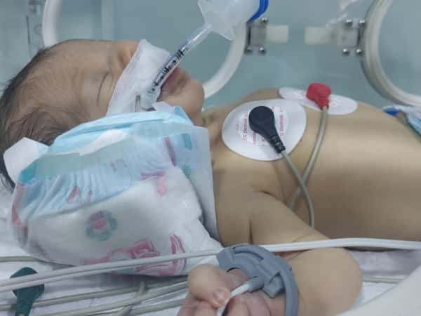 صغيرنا احمد بحاجة لعناية مركزة حتى يسترد صحته
