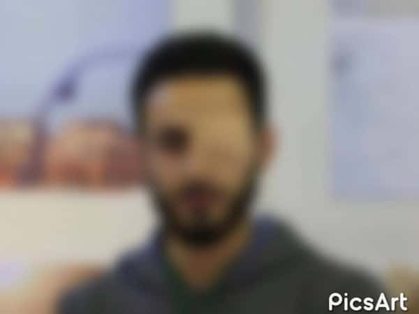 A guy needs an artifcial eye implant
