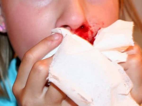 She fell and broke her nose, now requiring surgical intervention.