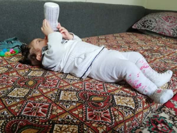 A child suffers from hip dislocation