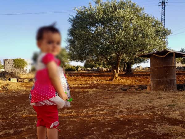 عمرها سنة تعاني من مشكلة في المشي تحتاج لعملية