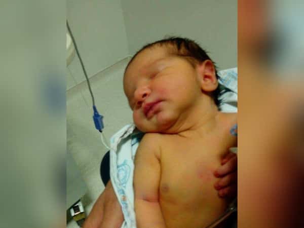 Baby needing treatment expenses