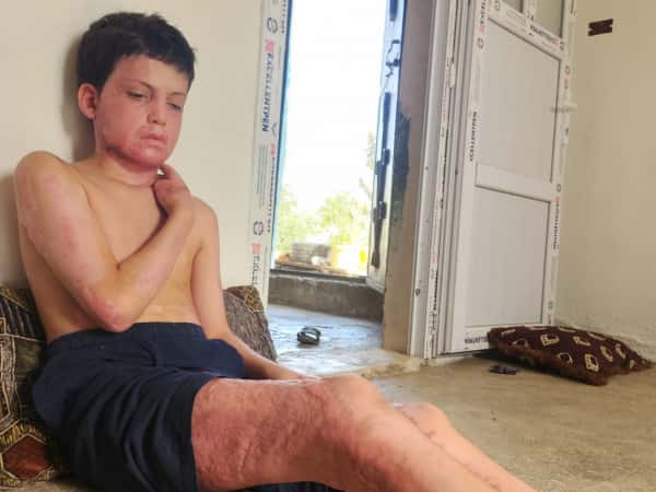 Ahmed needs your support to regain his childhood and live it in peace.