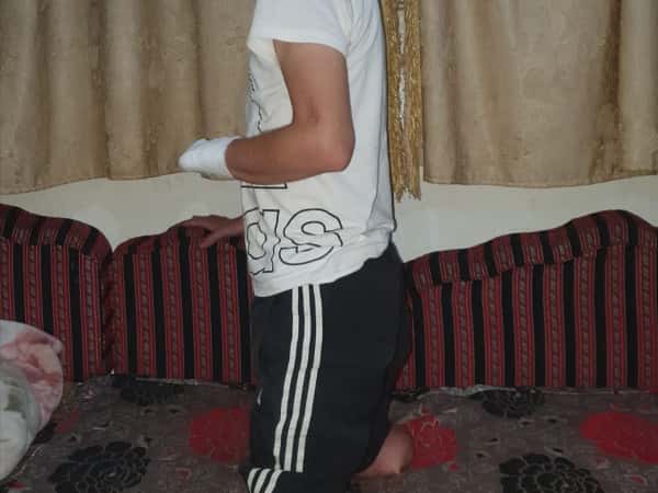 شاب فقد أطرافه وموطنه