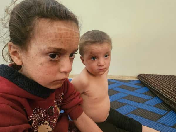 الكفالات الانسانية