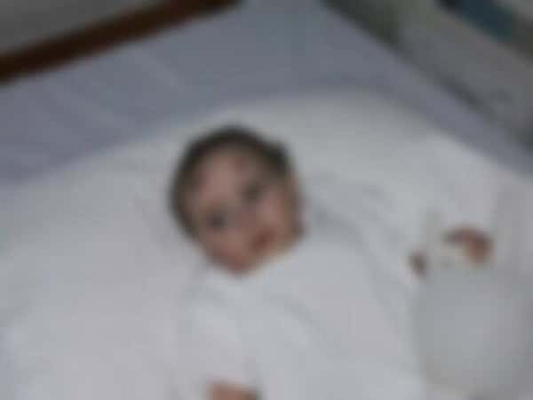 Child born with tumor mass