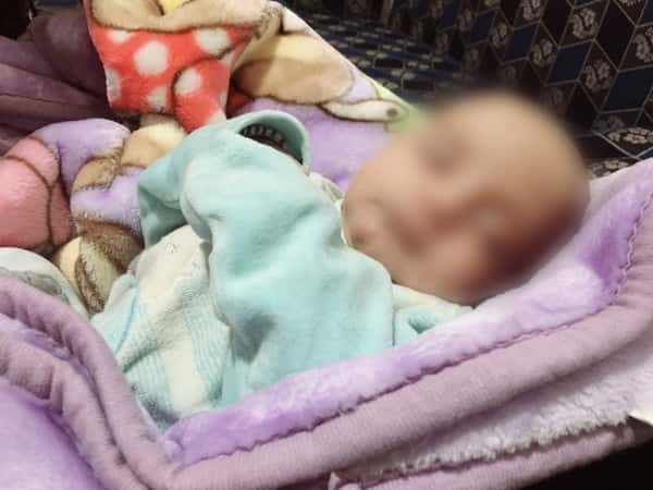 رضيع يعاني من فتق إِربي!