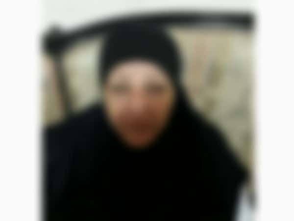 A woman suffers of cataract