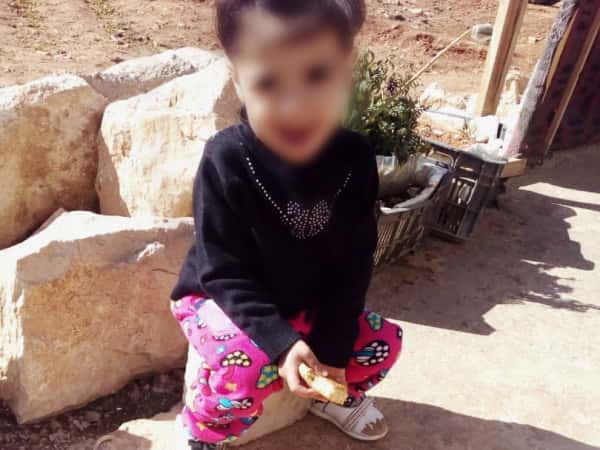 طفلة ولدت بتشوه خلقي