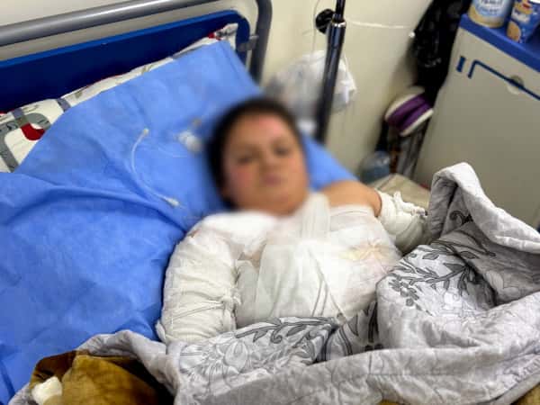 Help Little Fatima Heal From Severe Burns