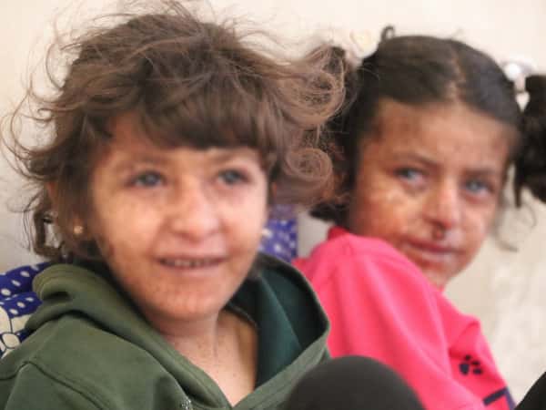 Shaima'a and Wa'ad are little girls suffer with sickness