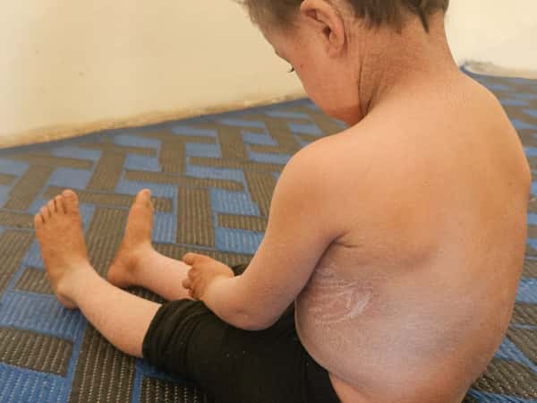 أسرة على حافة التعب