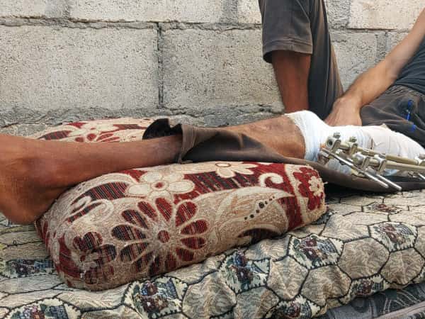 Amer has permanent disability and needs urgent help