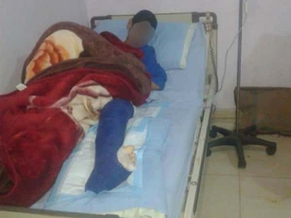 a young man who had an accident