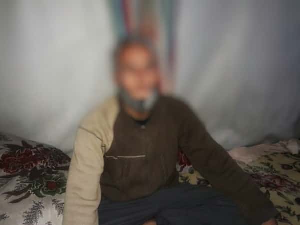 a man has a fractured jaw since he was in his sieged city!