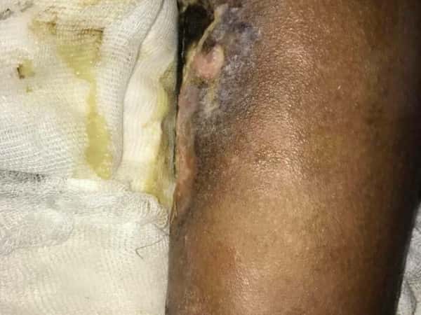 A patient needs treatment