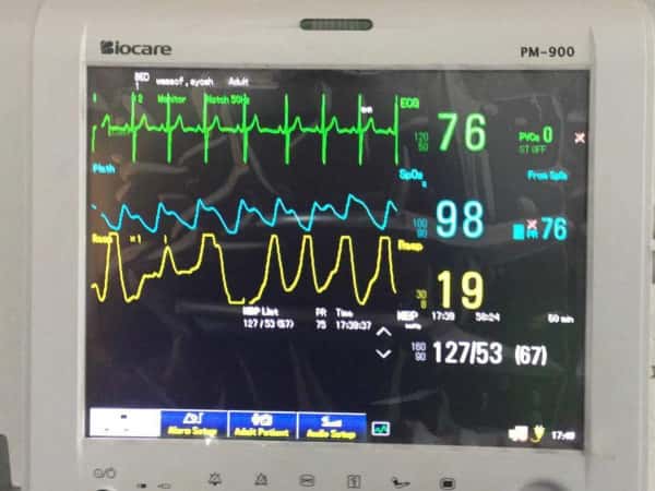 A Refugee in need for cardiac surgery within 2 days