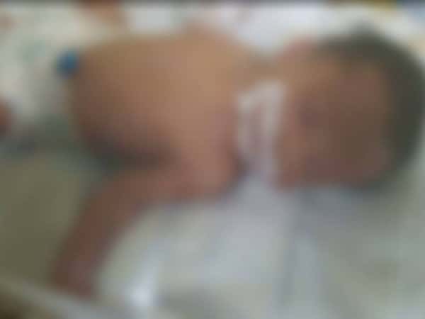 Newborn needing an incubator