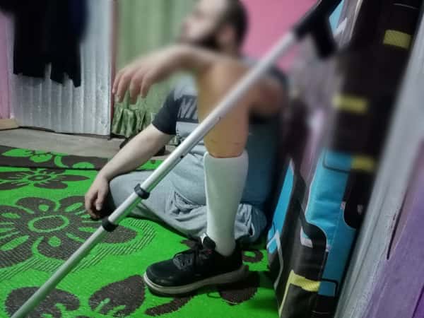 سليمان فقد قدميه الاثنتين وبحاجة مساعدة
