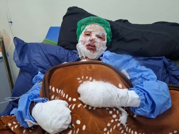 A fire stole the safety