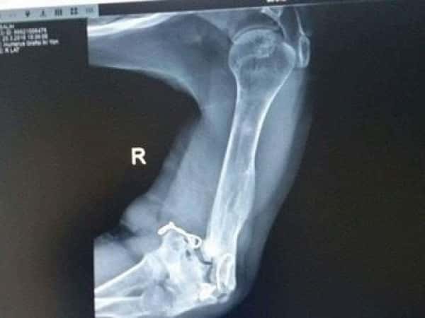 An Injured Man Needs a Surgery