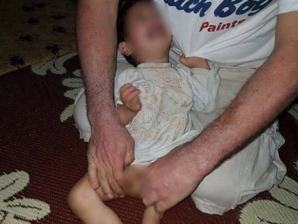 Urgent surgery for a baby