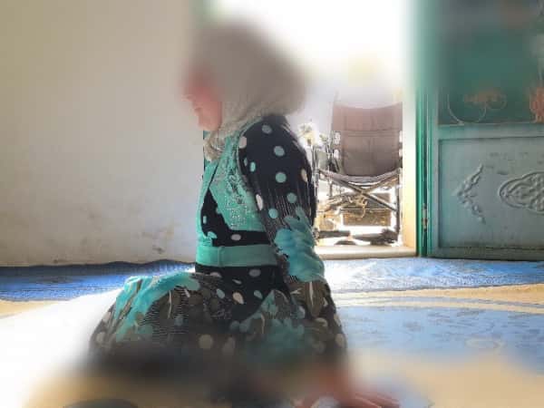 طفلة ولدت بأحد أنواع شلل النخاع الشوكي