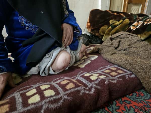 He lost both legs… and with them, the life he once knew.