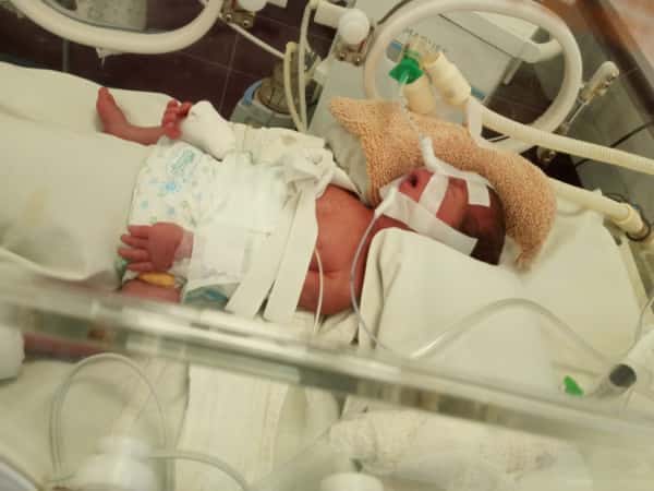Urgent Support Needed for Premature Baby Ayat's Medical Procedure