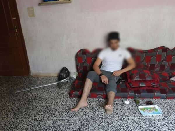 شاب أُصيب في الفخذ والساق بسبب الطيران الحربي