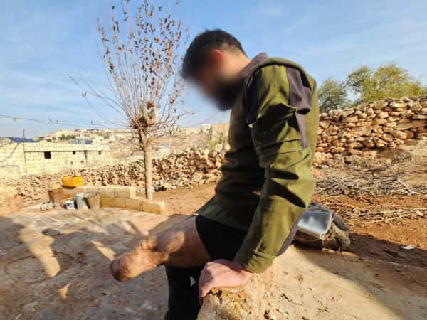 In a single instant, Saleh’s life was irrevocably altered.