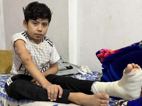 A child with acute kidney failure