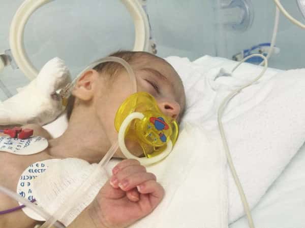 Surgery for a newborn