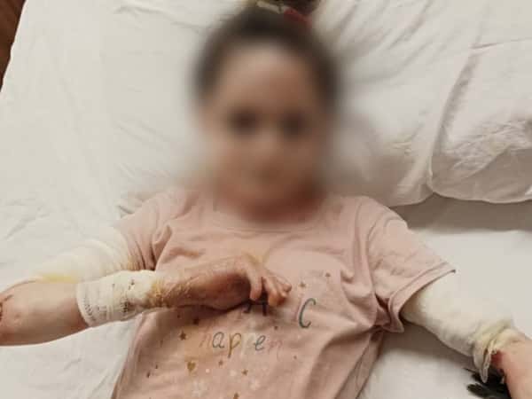 Ein Kind, das an Pemphigus leidet