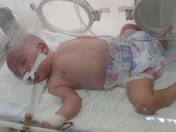 An infant with hepatitis