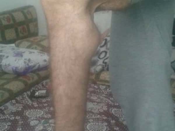 A refugee in need of a surgery